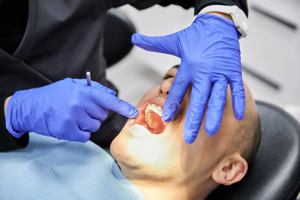 Best Emergency Wisdom Tooth Extraction in Pineville, KY